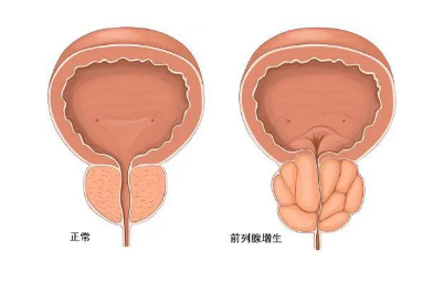 兩性健康 | 對于女性來說，最怕男人得什么?。?圖1)