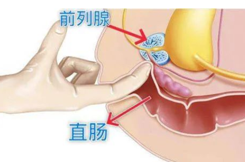 是時(shí)候重視了，1分鐘自測(cè)前列腺健康，達(dá)標(biāo)的不多